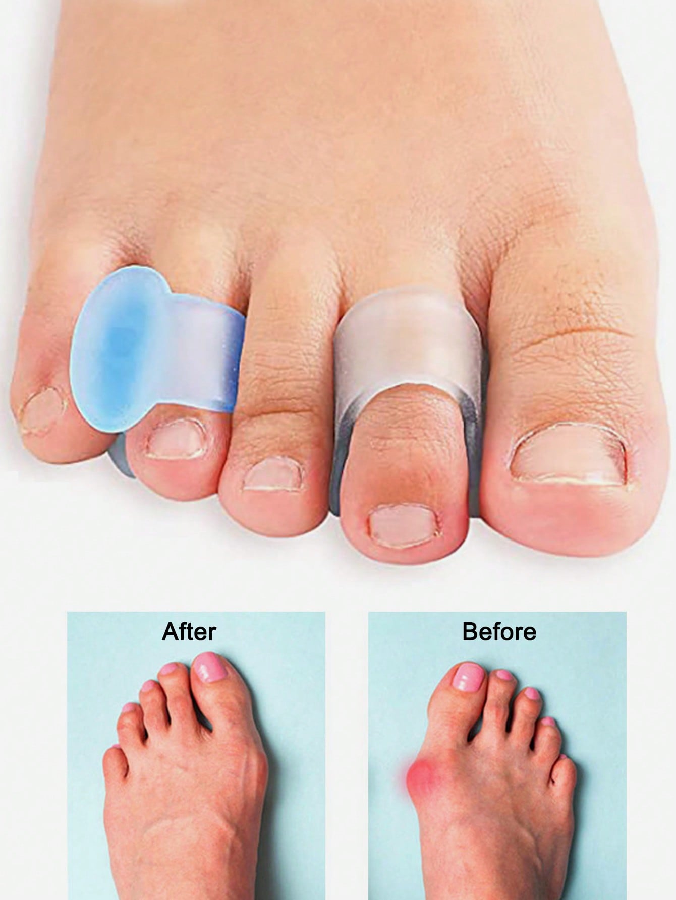Pemisah Jari Kaki Gel, 4 buah  - Yoga Toe Separator ulasan dan harga